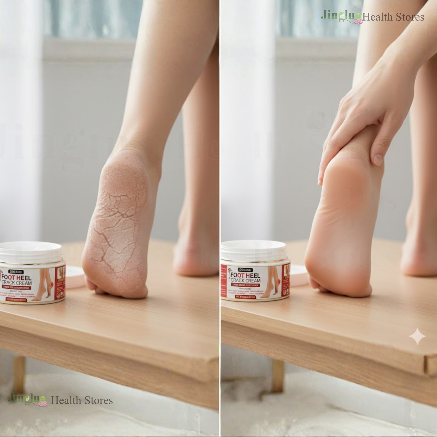 Foot Heel Crack Cream