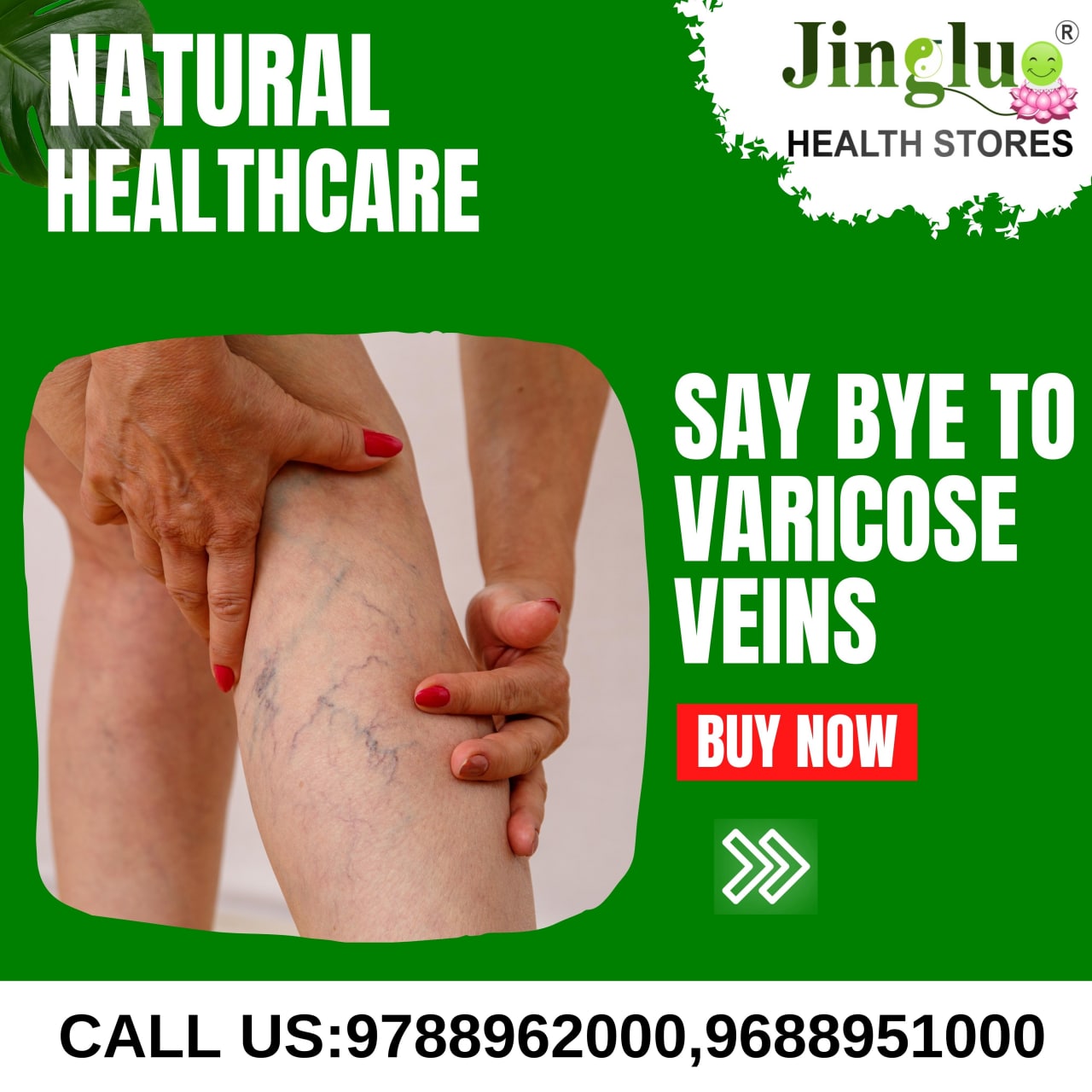 Varicose Veins Herbal Oil