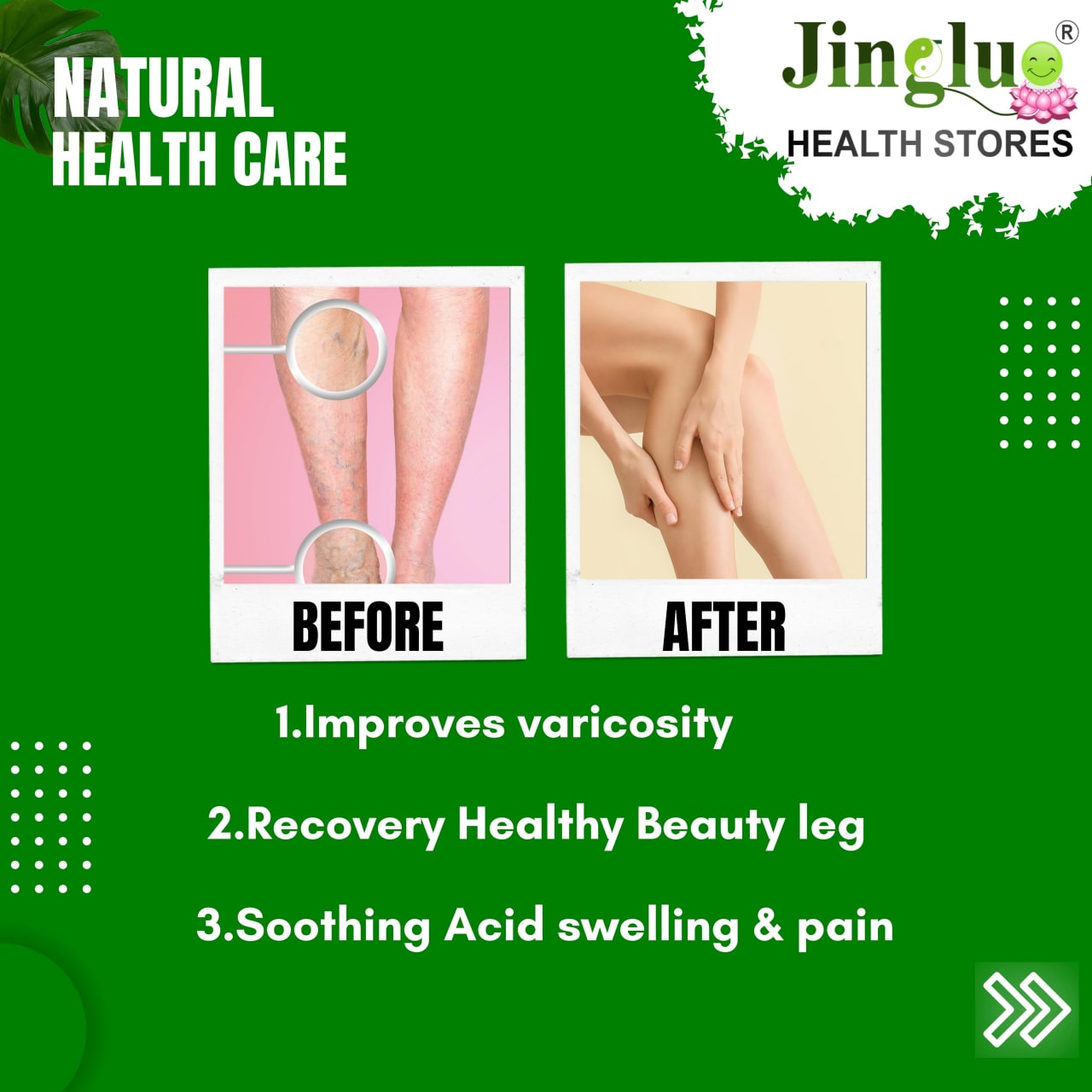 Varicose Veins Herbal Oil